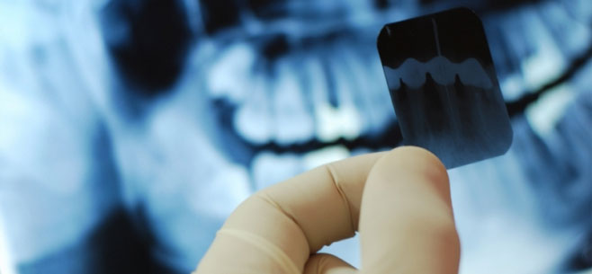 Прицельный снимок зуба в руках врача