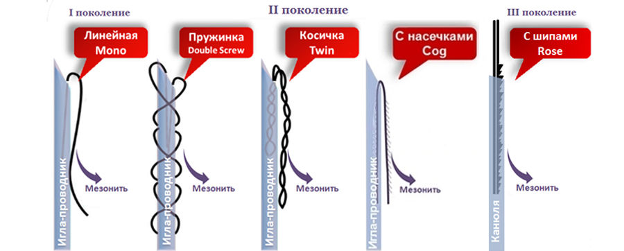 Разновидности мезонитей