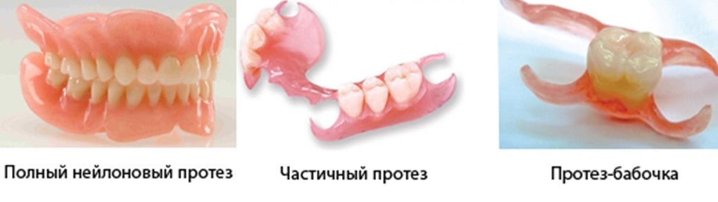 Нейлоновые зубные протезы: полный, частичный и бабочка