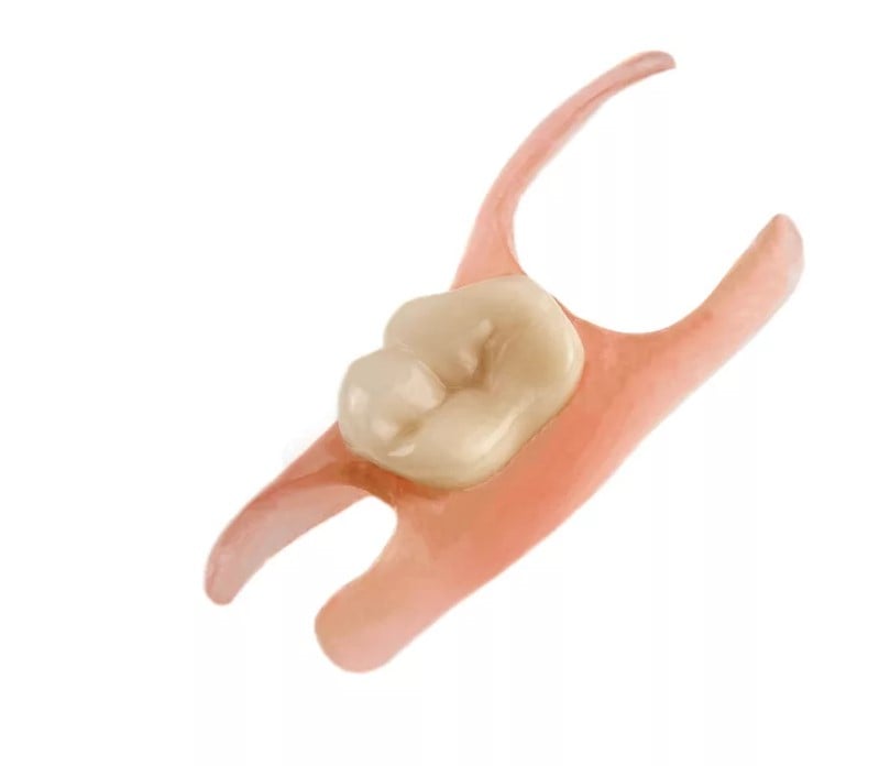 Акриловый зубной протез-бабочка