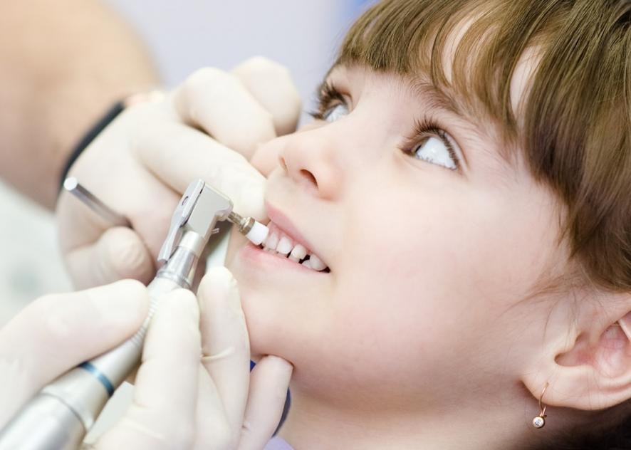 Профессиональная чистка зубов у ребенка в стоматологии