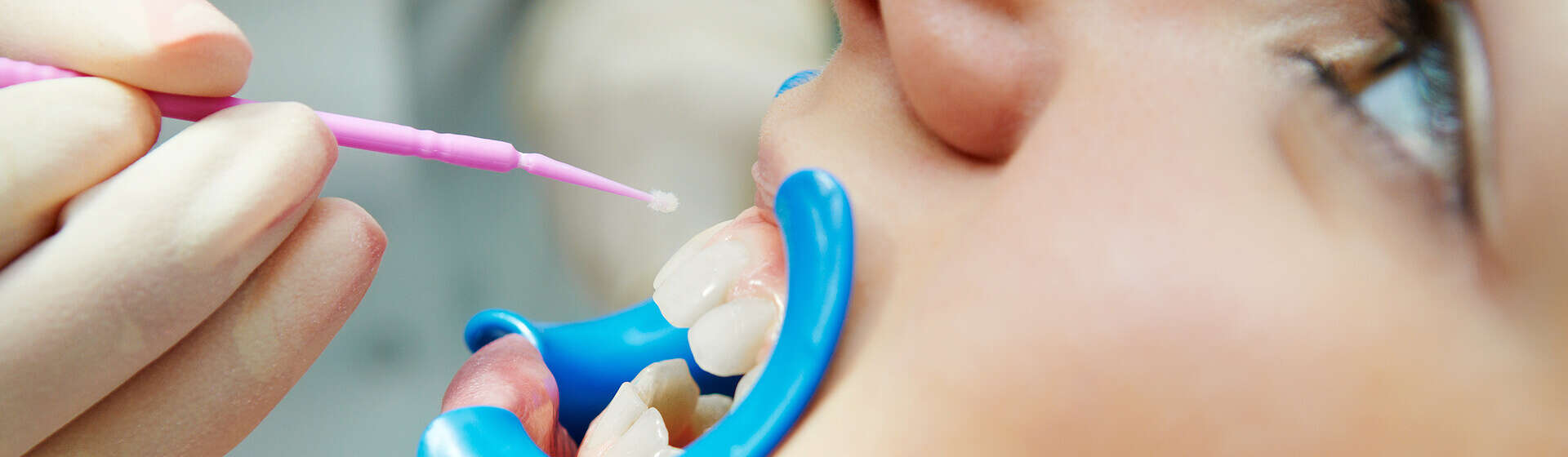 Процедура форирования зубов у ребенка